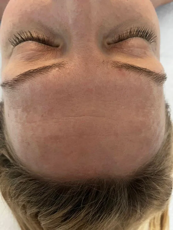 Przed masażem Kobido